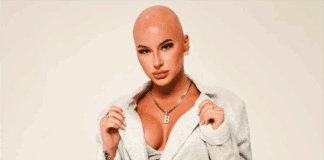 Chloe Bean: Inspiring Alopecia Journey and Empowerment Tips Runway-Magazine-Interview-Chloe Bean Inspiring Alopecia Journey and Empowerment Tips